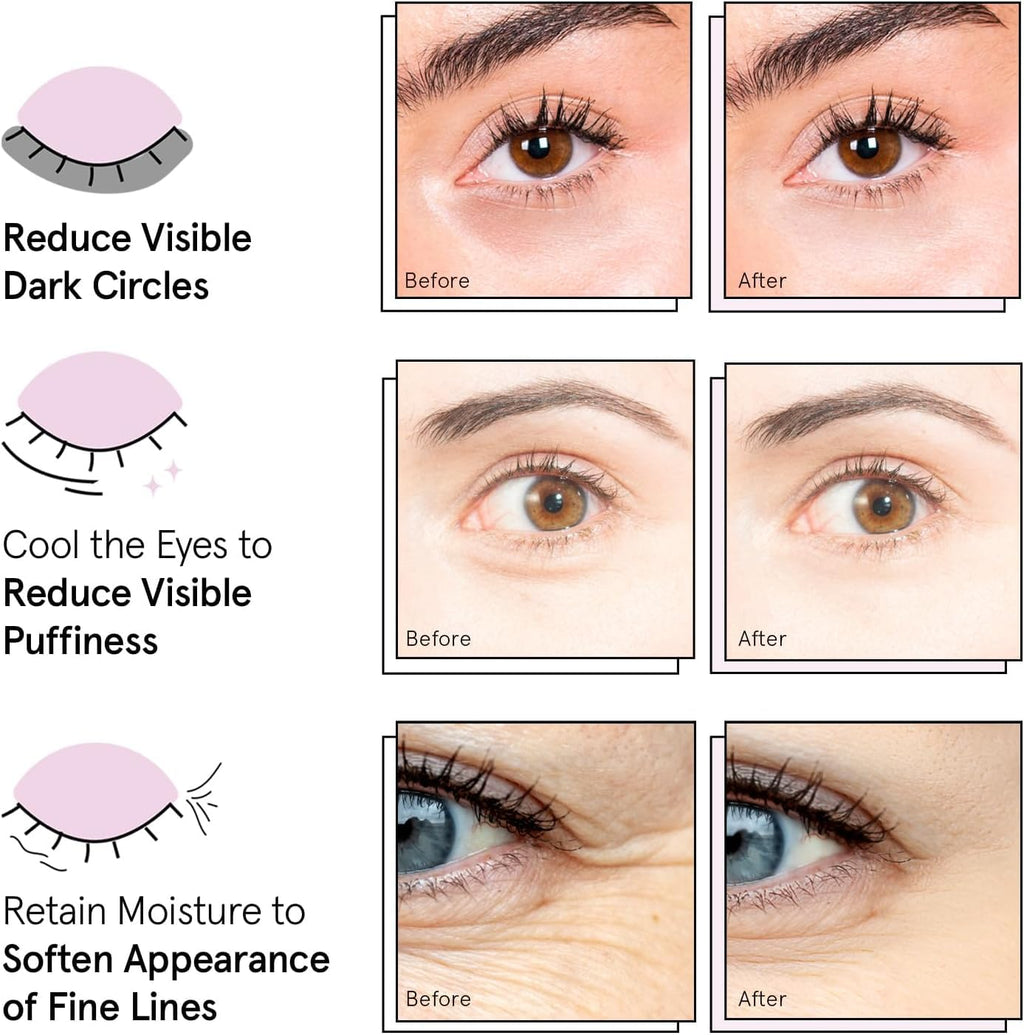 grace & stella Under Eye Patches Eye Masks for Puffy Eyes and Dark Circles