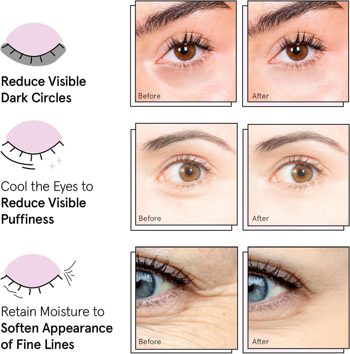 grace & stella Under Eye Patches Eye Masks for Puffy Eyes and Dark Circles