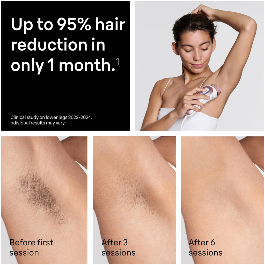 Braun Smart IPL, Skin i·Expert Pro 7, VOGUE's Best Hair Removal Device, IPL Hair Removal for Women and Men, Permanent Laser Hair Reduction At-Home, World's 1st Smart App, 3 Heads, IPL7243