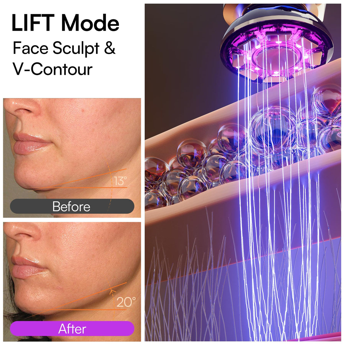 INIA FLARE 3-in-1 Red Light Therapy Beauty Device for Face & Neck Pink