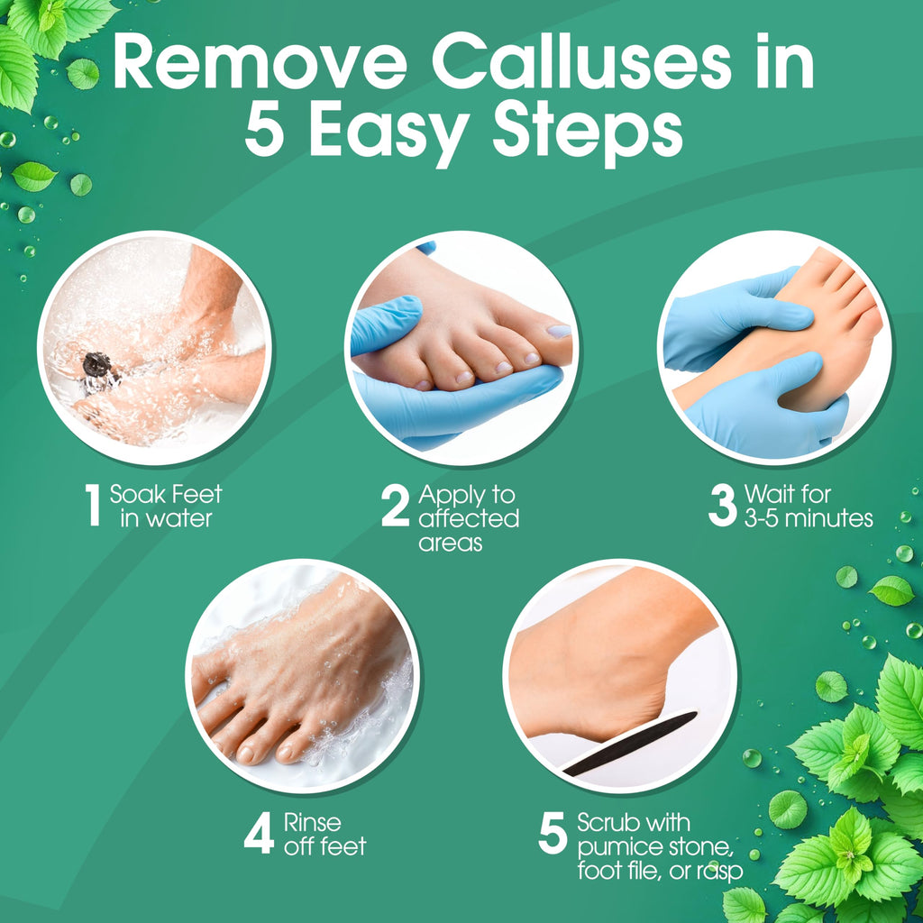 DeEnti Foot Callus Remover Gel, Dead Skin Remover for Feet, 8oz Cool Mint