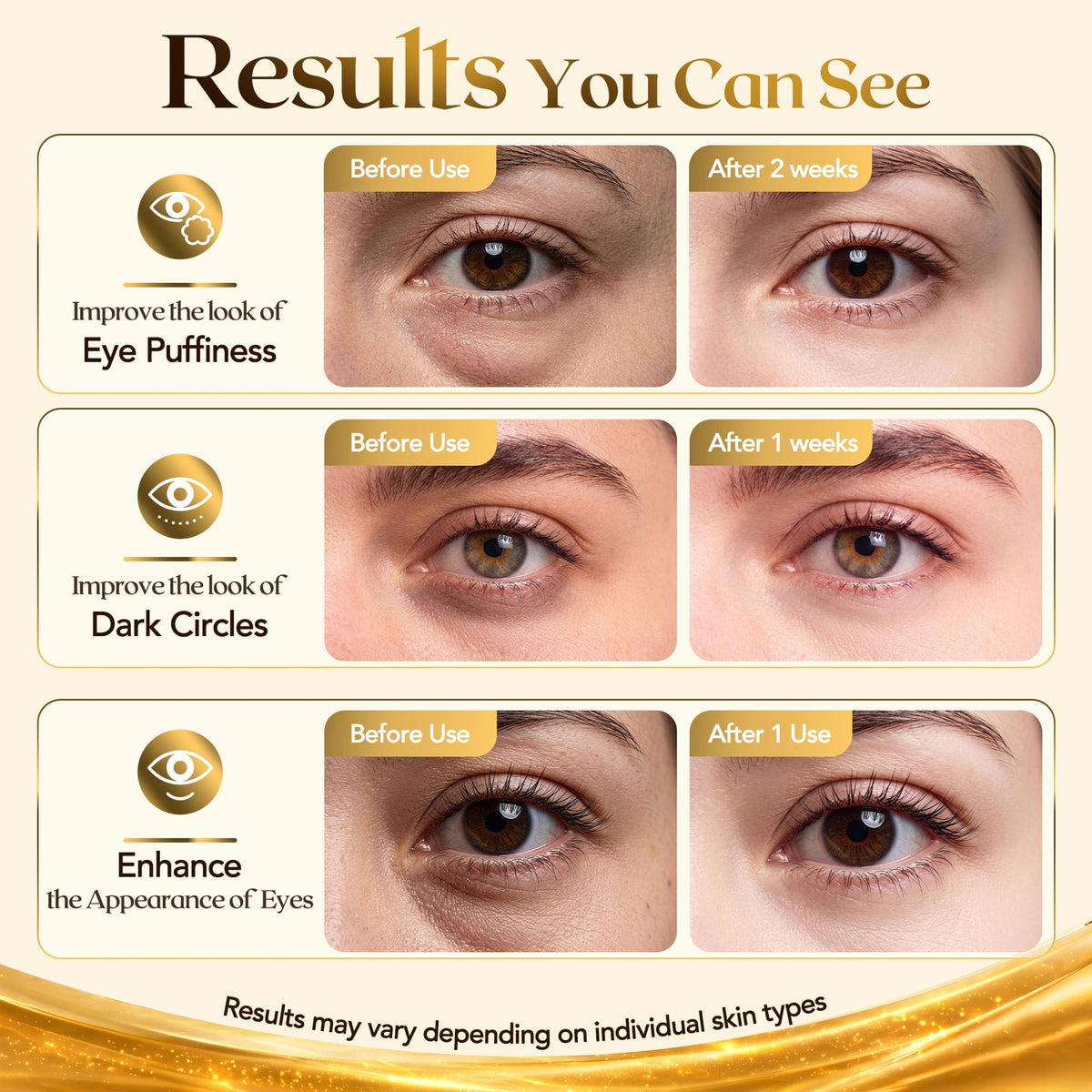 FENGOO 80 PCS 24K Gold Collagen Under Eye Patches & Smile Line Patches